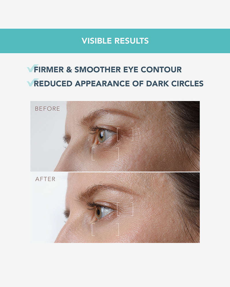Iris Firming Pm Eye Serum 15 Ml