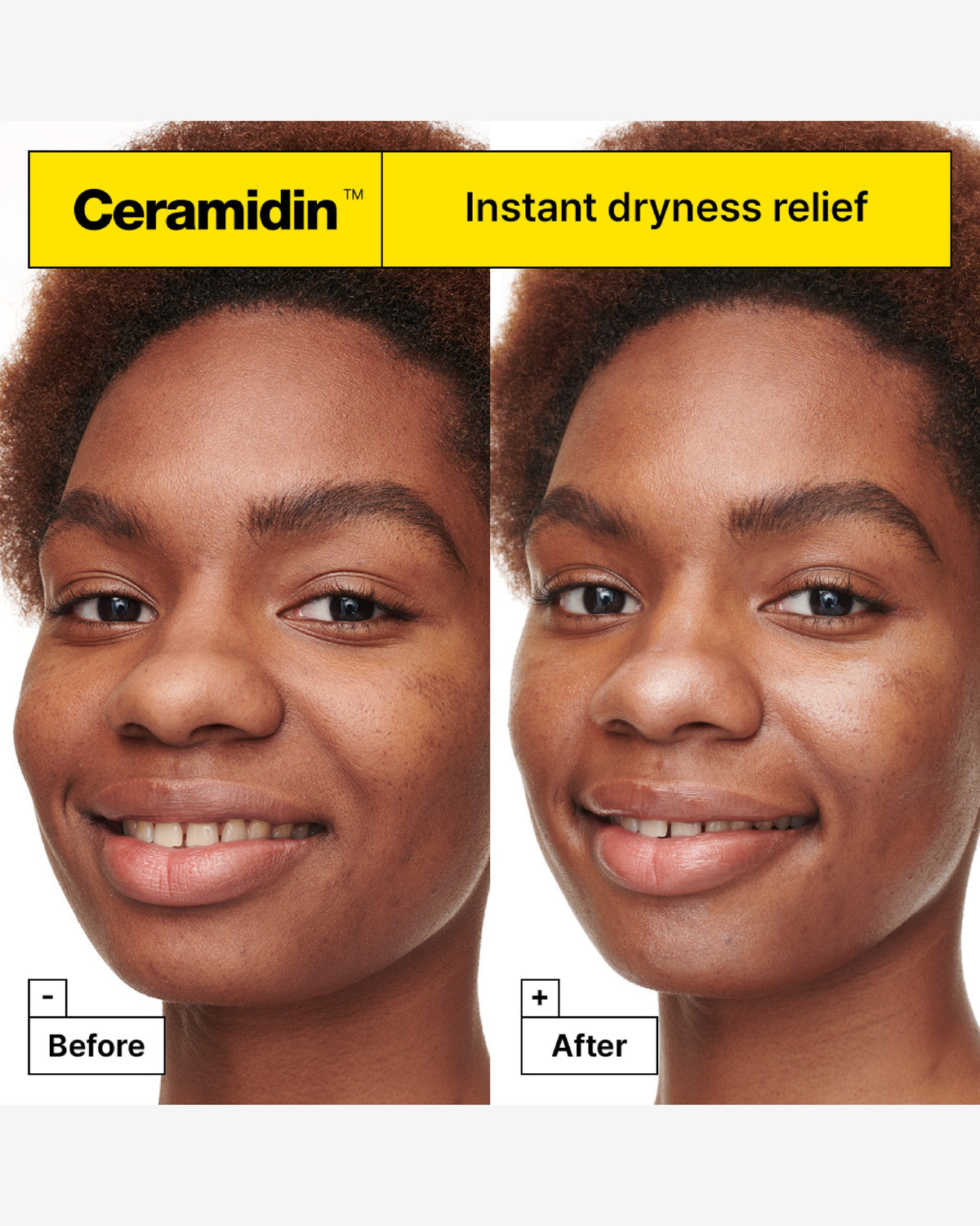 Ceramidin™ Skin Barrier Moisturising Cream
