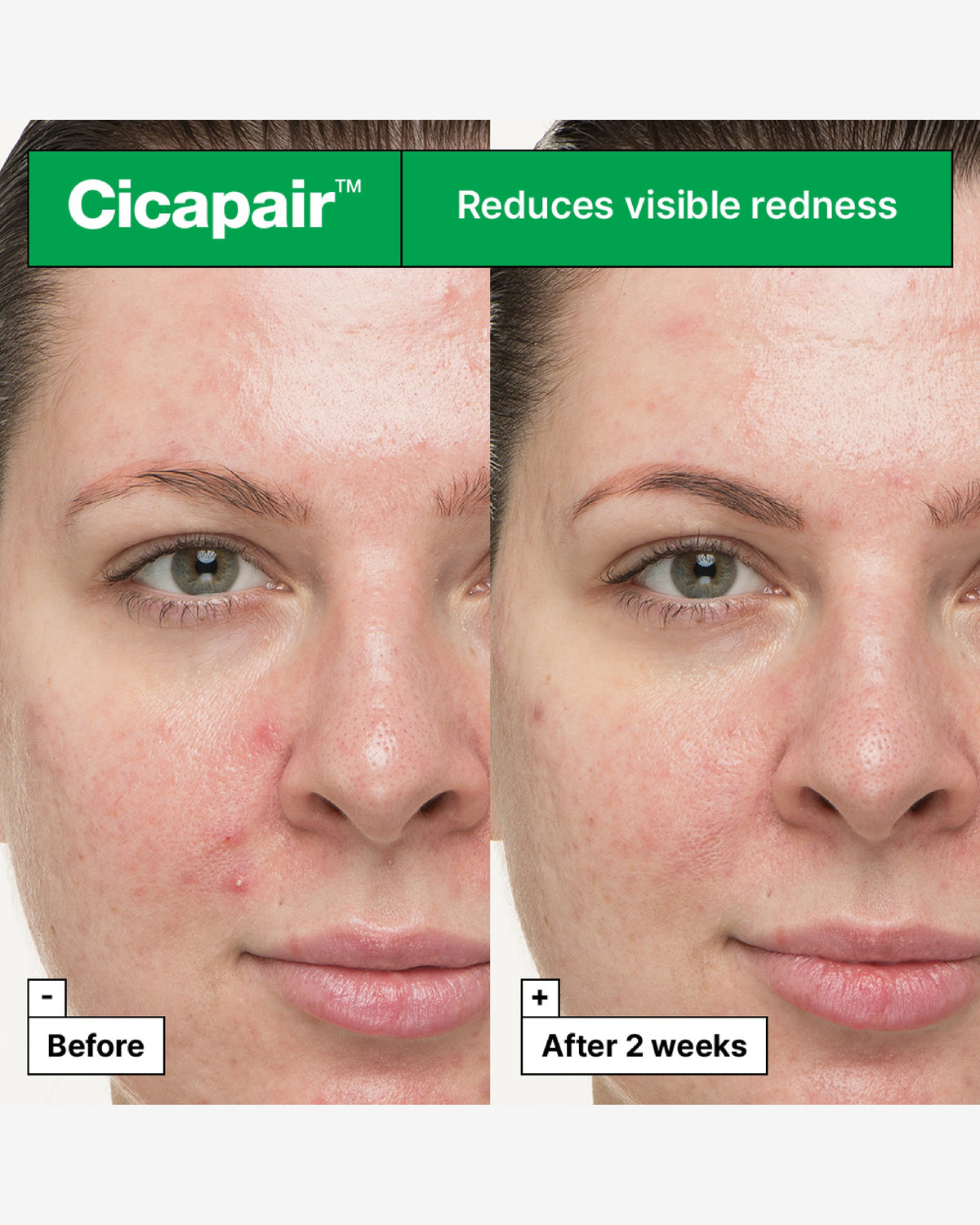 Cicapair™ So Soothing Treatment For Visibly Irritated Skin