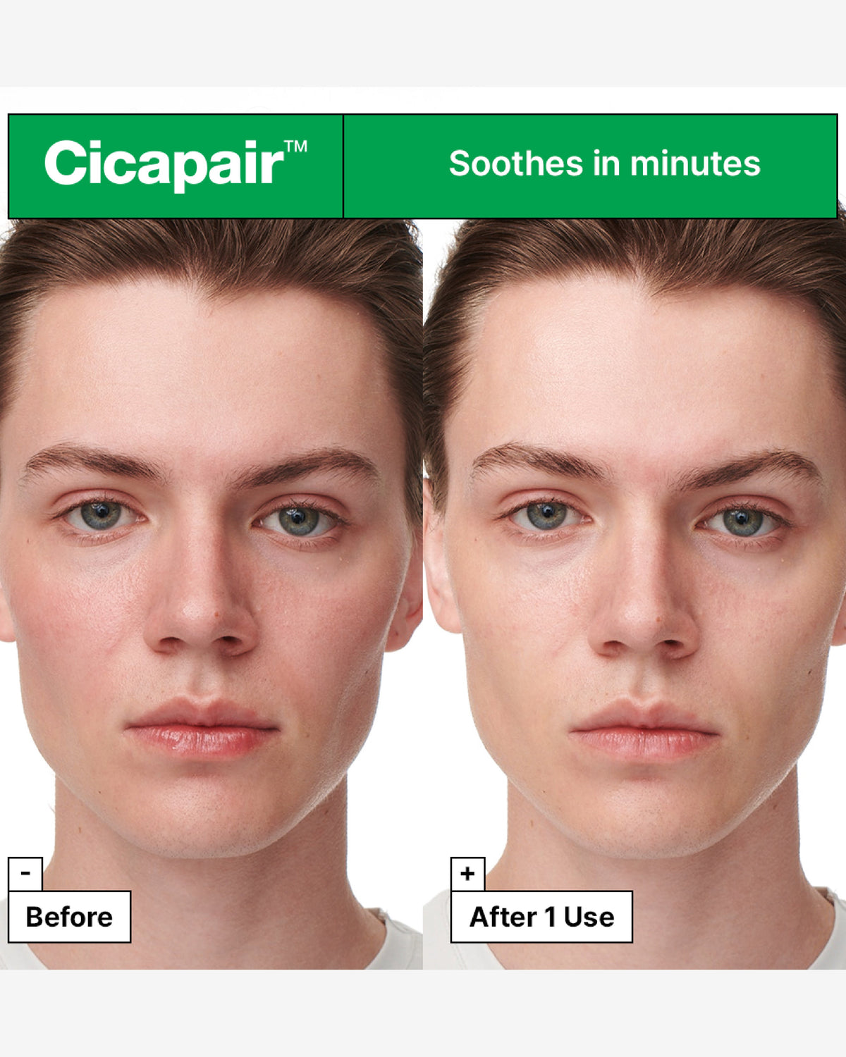 Cicapair™ Sensitive Skin Serum Face Mask For Redness