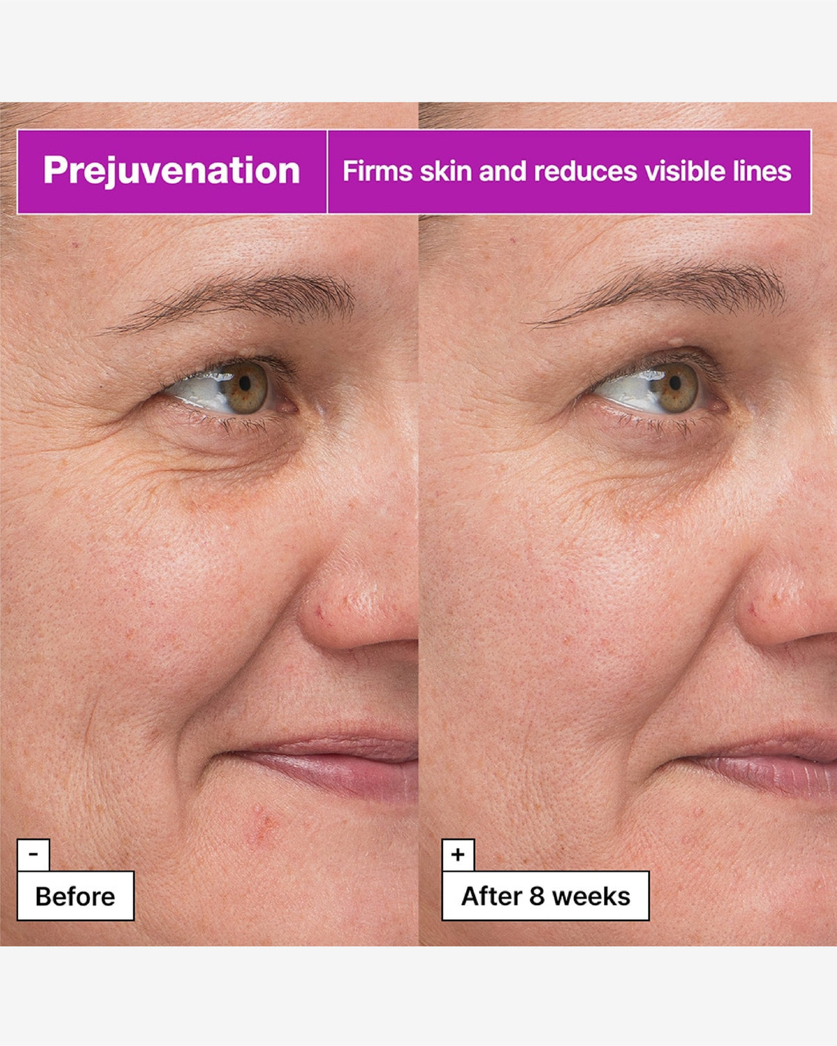 Prejuvenation Firming Bakuchiol Serum For Preventative Aging