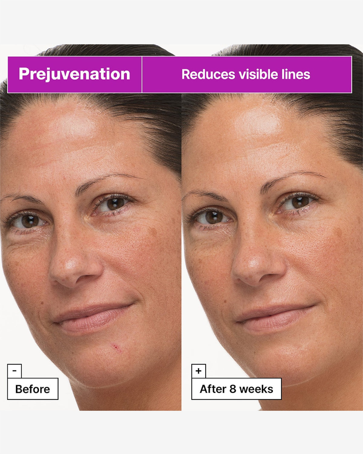 Prejuvenation Firming Bakuchiol Cream For Preventative Aging